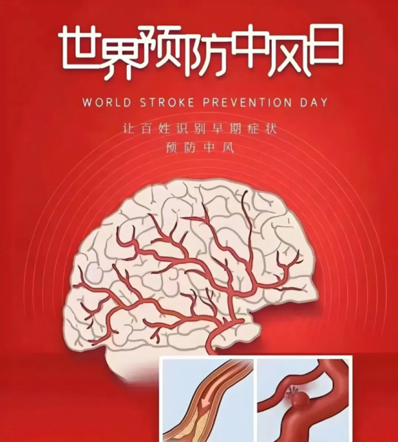警惕“中风”突袭！脑卒中全面科普(图1)